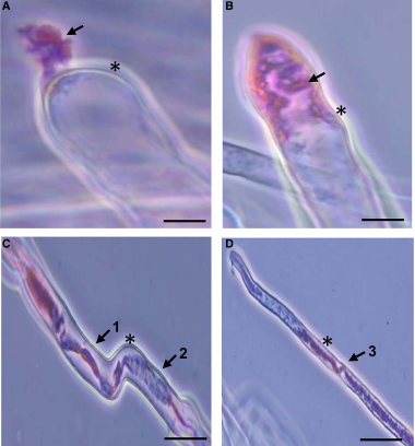 Synergistic Effects of a Root-Endophytic Trichoderma Fungus and Bacillus on Early Root Colonization and Defense Activation Against Verticillium longisporum in Rapeseed